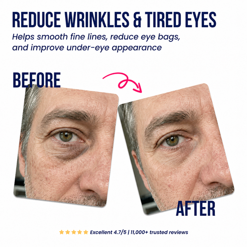 Cold Harbor™ Caffeine & Hyaluronic Acid Eye Patches | 60 Patches